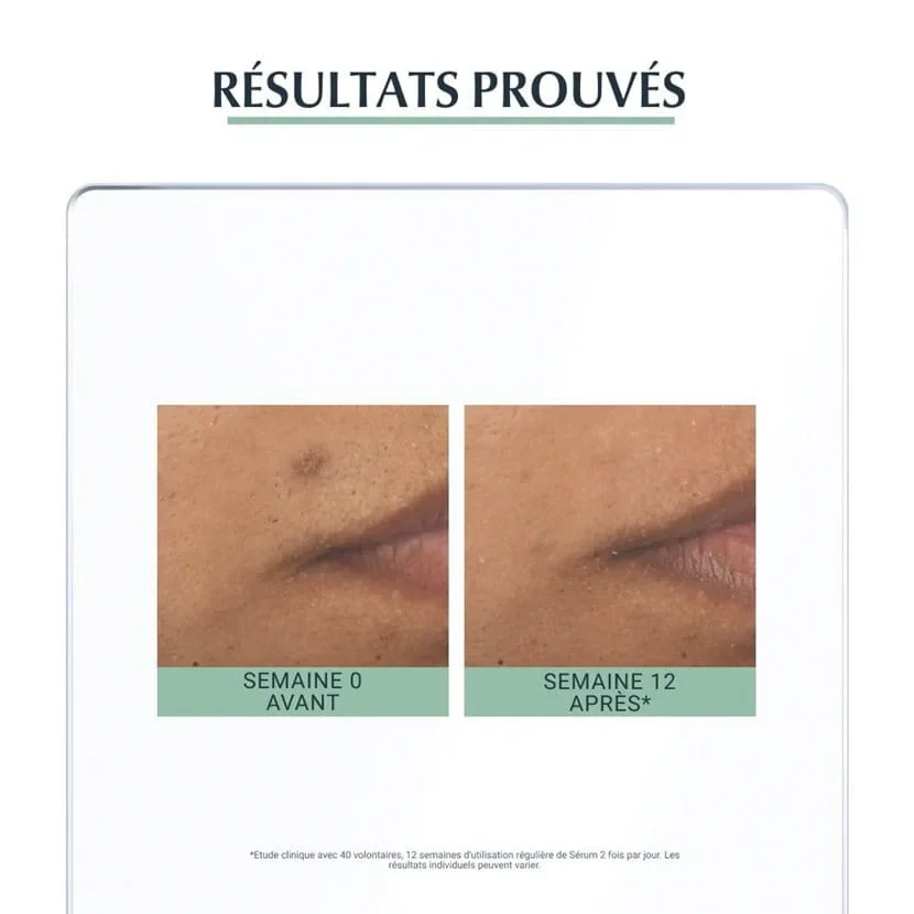 4005800295003-im5.webp EUCERIN DERMOPURE TRIPLE ACTION SERUM