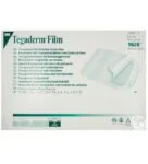 TEGADERM Pansement film Transparent avec Cadre 15 x 20 cm